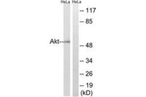 Western blot analysis of extracts from HeLa cells, using Akt (Ab-473) Antibody. (AKT1 anticorps  (AA 431-480))