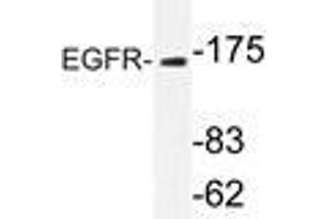 Western blot analysis of EGFR antibody in extracts from Jurkatcells. (EGFR anticorps)