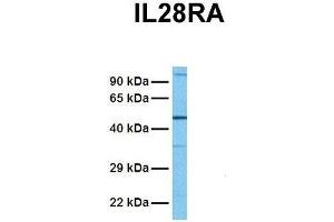 Host:  Rabbit  Target Name:  IL28RA  Sample Tissue:  Human Fetal Lung  Antibody Dilution:  1. (IL28RA anticorps  (N-Term))