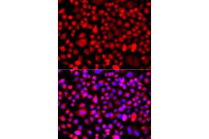 Immunofluorescence analysis of A549 cells using ALG1 antibody (ABIN5975731). (ALG1 anticorps)