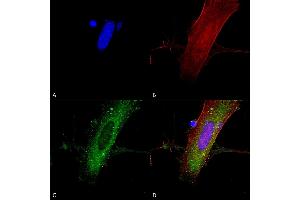 Immunocytochemistry/Immunofluorescence analysis using Mouse Anti-GluN2A/NR2A Monoclonal Antibody, Clone S327A-38 (ABIN2483889). (NMDAR2A anticorps  (AA 75-325) (Atto 594))