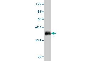 Western Blot detection against Immunogen (36. (CALCOCO2 anticorps  (AA 347-446))