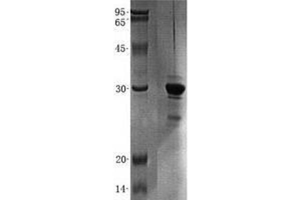 PYM Protein (Transcript Variant 2) (His tag)