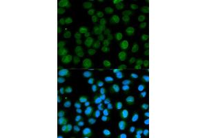 Immunofluorescence analysis of HeLa cell using EMD antibody. (Emerin anticorps)