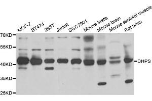 Western blot analysis of extracts of various cell lines, using DHPS antibody (ABIN5973774) at 1/1000 dilution. (DHPS anticorps)