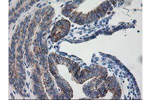 Image no. 2 for anti-Adenylate Kinase 4 (AK4) antibody (ABIN1496527) (AK4 anticorps)