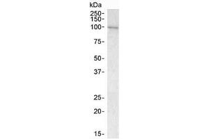 Western blot testing of human bone marrow lysate with VAV3 antibody at 1ug/ml. (VAV3 anticorps)