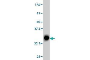 Western Blot detection against Immunogen (36. (Patched 1 anticorps  (AA 841-940))