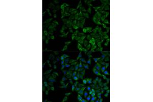 Immunofluorescence analysis of HeLa cells using TNFRSF1A antibody (ABIN1875131). (TNFRSF1A anticorps)