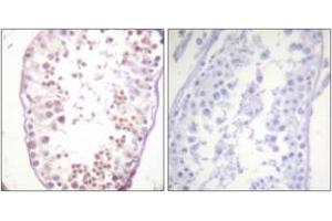 Immunohistochemistry analysis of paraffin-embedded human testis, using HDAC6 (Phospho-Ser22) Antibody. (HDAC6 anticorps  (pSer22))