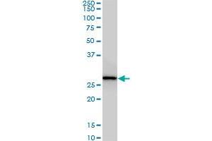 CNOT7 monoclonal antibody (M01A), clone 2F6. (CNOT7 anticorps  (AA 1-285))