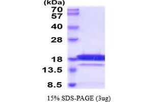 SDS-PAGE (SDS) image for Retinoic Acid Receptor Responder (Tazarotene Induced) 2 (RARRES2) (AA 21-157) protein (His tag) (ABIN6387949) (Chemerin Protein (AA 21-157) (His tag))