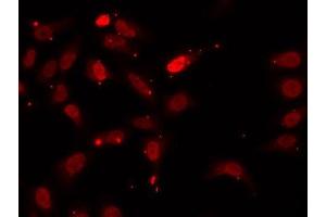 Immunofluorescence analysis of U2OS cells using HNRNPF antibody. (HNRNPF anticorps  (AA 1-280))