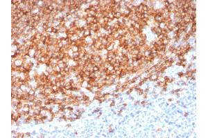 Formalin-fixed, paraffin-embedded human Tonsil stained with CD20 Mouse Monoclonal Antibody (MS4A1/3410). (CD20 anticorps  (AA 213-297))