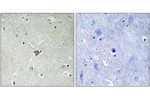 Immunohistochemistry (IHC) image for anti-BCL2-Associated X Protein (BAX) (AA 143-192) antibody (ABIN2889141) (BAX anticorps  (AA 143-192))