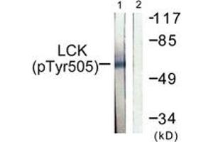 Western blot analysis of extracts from Jurkat cells, using Lck (Phospho-Tyr505) Antibody. (LCK anticorps  (pTyr505))