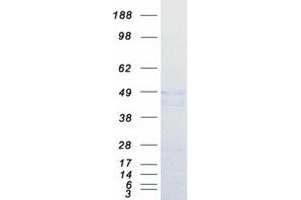 CPA5 Protein (Transcript Variant 1) (Myc-DYKDDDDK Tag)