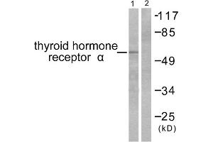 Western blot analysis of extracts from SKOV3 cells, using Thyroid Hormone Receptor alpha antibody (ABIN5976520). (THRA anticorps  (N-Term))