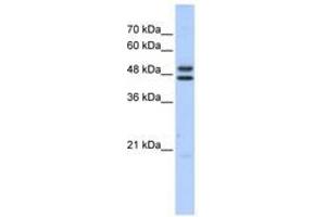 Image no. 1 for anti-Excision Repair Cross-Complementing Rodent Repair Deficiency, Complementation Group 8 (ERCC8) (C-Term) antibody (ABIN6741466) (ERCC8 anticorps  (C-Term))