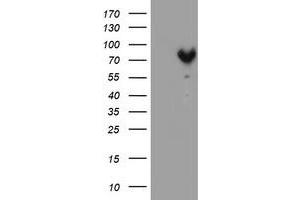 HEK293T cells were transfected with the pCMV6-ENTRY control (Left lane) or pCMV6-ENTRY MPP5 (Right lane) cDNA for 48 hrs and lysed. (MPP5 anticorps)