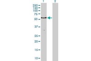 Western Blot analysis of PCTK1 expression in transfected 293T cell line by PCTK1 MaxPab polyclonal antibody. (CDK16 anticorps  (AA 1-496))