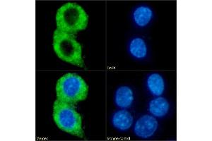 Immunofluorescence staining of fixed RAW264. (Recombinant CMKLR1 anticorps  (AA 8-32))
