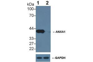 Knockout Varification: ;Lane 1: Wild-type Hela cell lysate; ;Lane 2: ANXA1 knockout Hela cell lysate; ;Predicted MW: 39kDa ;Observed MW: 39kDa;Primary Ab: 2µg/ml Mouse Anti-Human ANXA1 Antibody;Second Ab: 0. (Annexin a1 anticorps  (AA 1-346))