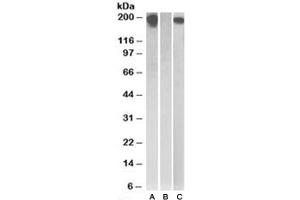 Western blot testing of HEK293 lysate overexpressing Human CSF1R with MYC tag with CSF1R antibody (0. (CSF1R anticorps)
