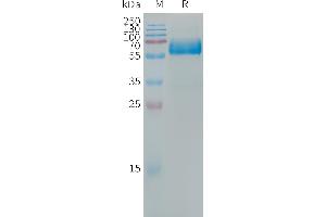 Human LOX-1 Protein, hFc Tag on SDS-PAGE under reducing condition. (OLR1 Protein (Fc Tag))
