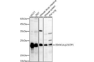 Western blot analysis of extracts of various cell lines, using CDKN1A/p21CIP1 antibody (ABIN1679159, ABIN1679158, ABIN3016472 and ABIN6219758) at 1:1000 dilution. (p21 anticorps  (AA 1-164))