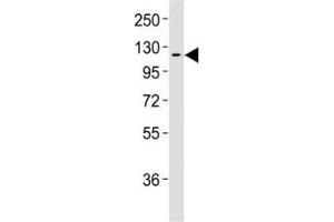 Western blot testing of CSF1R antibodyat 1:2000 dilution + human placenta lysate; (CSF1R anticorps)