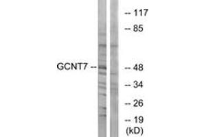 Western Blotting (WB) image for anti-Glucosaminyl (N-Acetyl) Transferase Family Member 7 (GCNT7) (AA 311-360) antibody (ABIN2890158) (GCNT7 anticorps  (AA 311-360))