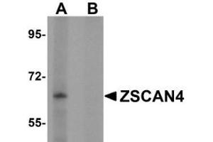 Western blot analysis of ZSCAN4 in mouse lung tissue lysate with AP31008PU-N in (A) the absence and (B) presence of peptide blocking. (ZSCAN4 anticorps  (C-Term))