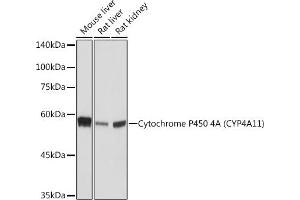 Western blot analysis of extracts of various cell lines, using Cytochrome P450 4A (CYP4) (CYP4) Rabbit mAb (ABIN7266658) at 1:1000 dilution. (CYP4A11 anticorps)