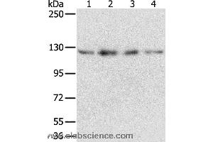 Western blot analysis of Huvec, hepg2, 293T and A549 cell, using RBM5 Polyclonal Antibody at dilution of 1:500 (RBM5 anticorps)