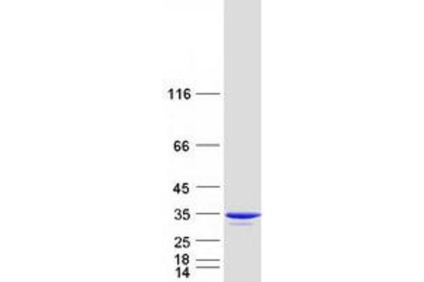 DUPD1 Protein (Myc-DYKDDDDK Tag)