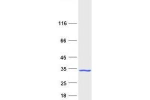 Validation with Western Blot (BID Protein (Transcript Variant 2) (Myc-DYKDDDDK Tag))