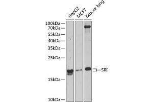 Western blot analysis of extracts of various cell lines, using SRI Antibody  at 1:1000 dilution. (SRI anticorps  (AA 1-198))