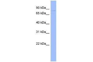 WB Suggested Anti-GPD2 Antibody Titration:  0. (GPD2 anticorps  (N-Term))
