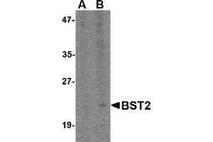 Western Blotting (WB) image for anti-Bone Marrow Stromal Cell Antigen 2 (BST2) (N-Term) antibody (ABIN1031283) (BST2 anticorps  (N-Term))