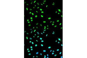Immunofluorescence analysis of HeLa cell using CDC20 antibody. (CDC20 anticorps  (AA 1-270))