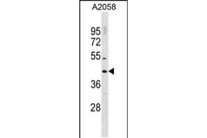 Western blot analysis in A2058 cell line lysates (35ug/lane). (DNAJC25 anticorps  (AA 211-239))