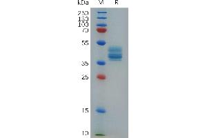 Cynomolgus A Protein, His Tag on SDS-PAGE under reducing condition. (Annexin A2 Protein (ANXA2) (AA 2-339) (His tag))