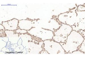 Immunohistochemistry (IHC) image for anti-Desmin (DES) antibody (ABIN5958489) (Desmin anticorps)