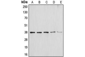 Western blot analysis of Annexin A1 expression in HEK293T (A), NIH3T3 (B), THP1 (C), Molt4 (D), HepG2 (E) whole cell lysates. (Annexin a1 anticorps  (Center))