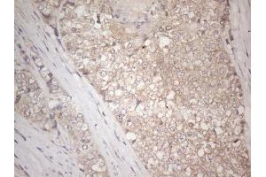 Immunohistochemistry (IHC) image for anti-Insulin-Like Growth Factor Binding Protein 1 (IGFBPI) (AA 26-259) antibody (ABIN2676854) (IGFBPI anticorps  (AA 26-259))