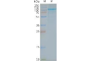 Human -Nanodisc, Flag Tag on SDS-PAGE (TLR5 Protéine)