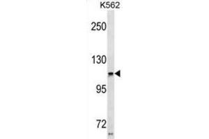 Western Blotting (WB) image for anti-Usher Syndrome 1C (Autosomal Recessive, Severe) (USH1C) antibody (ABIN3001013) (USH1C anticorps)