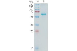 Cynomolgus ALPP Protein, His Tag on SDS-PAGE under reducing condition. (PLAP Protein (AA 21-504) (His tag))