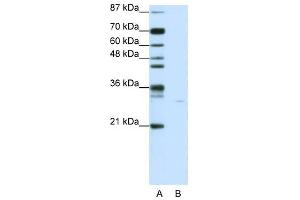 PDCD8 antibody used at 0. (AIF anticorps  (C-Term))